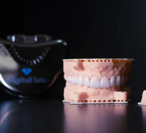 Lentes de Contato Dental